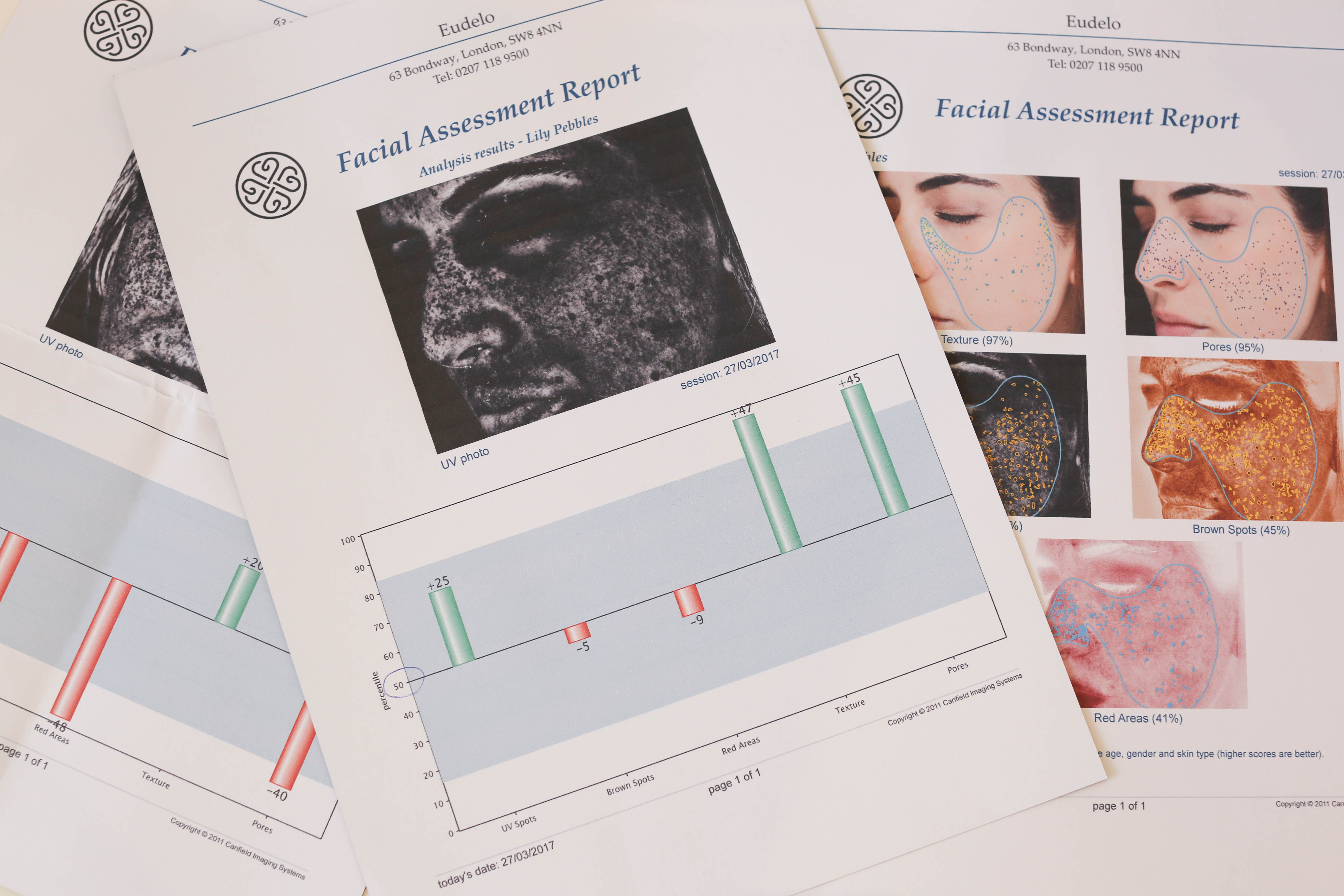 MY SKIN ANALYSIS & NEW ROUTINE